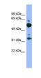 Membrane Palmitoylated Protein 2 antibody, orb330872, Biorbyt, Western Blot image 