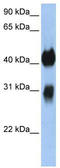 Homeobox protein OTX1 antibody, TA330153, Origene, Western Blot image 