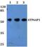 ATPase H+ Transporting Accessory Protein 1 antibody, PA5-37234, Invitrogen Antibodies, Western Blot image 