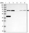 ERCC Excision Repair 2, TFIIH Core Complex Helicase Subunit antibody, NBP2-38382, Novus Biologicals, Western Blot image 