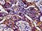 Homeobox protein Hox-B4 antibody, LS-C673290, Lifespan Biosciences, Immunohistochemistry paraffin image 