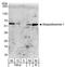 Sequestosome 1 antibody, A302-855A, Bethyl Labs, Western Blot image 