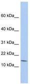 BTG Anti-Proliferation Factor 2 antibody, TA333912, Origene, Western Blot image 