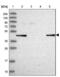 Galactokinase 2 antibody, NBP2-48900, Novus Biologicals, Western Blot image 