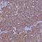 Charged multivesicular body protein 2a antibody, HPA041153, Atlas Antibodies, Immunohistochemistry frozen image 