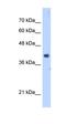 Decaprenyl-diphosphate synthase subunit 1 antibody, orb325255, Biorbyt, Western Blot image 