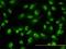 ACD antibody, H00065057-M02, Novus Biologicals, Immunofluorescence image 