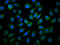 Methylcrotonoyl-CoA Carboxylase 1 antibody, LS-C680833, Lifespan Biosciences, Immunofluorescence image 