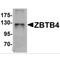 Zinc Finger And BTB Domain Containing 4 antibody, MBS151571, MyBioSource, Western Blot image 