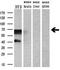 Mtg8 antibody, M01792, Boster Biological Technology, Western Blot image 