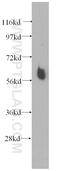IlvB Acetolactate Synthase Like antibody, 11220-1-AP, Proteintech Group, Western Blot image 