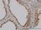 Gamma-Glutamyltransferase 1 antibody, H00002678-M01, Novus Biologicals, Immunohistochemistry paraffin image 