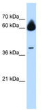 Matrix Metallopeptidase 23B antibody, TA341873, Origene, Western Blot image 