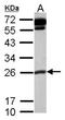 COMM Domain Containing 10 antibody, NBP2-15949, Novus Biologicals, Western Blot image 