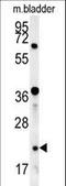 BLOC-1 Related Complex Subunit 5 antibody, LS-C165842, Lifespan Biosciences, Western Blot image 