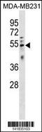 HtrA Serine Peptidase 4 antibody, 60-791, ProSci, Western Blot image 