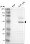 Serpin Family A Member 3 antibody, HPA000893, Atlas Antibodies, Western Blot image 