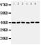 Cellular Communication Network Factor 4 antibody, PA2089, Boster Biological Technology, Western Blot image 
