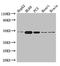 Zinc Finger Protein 2 antibody, LS-C680083, Lifespan Biosciences, Western Blot image 