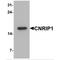 Cannabinoid Receptor Interacting Protein 1 antibody, MBS153485, MyBioSource, Western Blot image 
