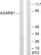 Double-stranded RNA-specific editase 1 antibody, abx013558, Abbexa, Western Blot image 