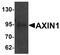 Axin 1 antibody, PA5-21042, Invitrogen Antibodies, Western Blot image 