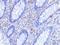 ST6 antibody, AHP1709, Bio-Rad (formerly AbD Serotec) , Western Blot image 