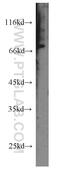 Phosphatase and actin regulator 4 antibody, 13408-1-AP, Proteintech Group, Western Blot image 