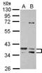Ts Translation Elongation Factor, Mitochondrial antibody, NBP2-20746, Novus Biologicals, Western Blot image 