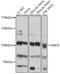 Meiosis Regulator For Oocyte Development antibody, 18-332, ProSci, Western Blot image 