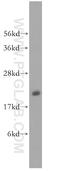 Ras-related protein Rab-35 antibody, 11329-2-AP, Proteintech Group, Western Blot image 