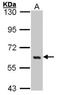 YES Proto-Oncogene 1, Src Family Tyrosine Kinase antibody, NBP1-31297, Novus Biologicals, Western Blot image 