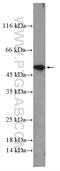 GFAP antibody, 16825-1-AP, Proteintech Group, Western Blot image 