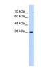 Asparagine-linked glycosylation 1 homolog pseudogene antibody, NBP1-70606, Novus Biologicals, Western Blot image 