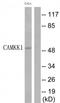 Calcium/calmodulin-dependent protein kinase kinase 1 antibody, TA315906, Origene, Western Blot image 