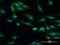 Origin Recognition Complex Subunit 6 antibody, H00023594-D01P, Novus Biologicals, Immunofluorescence image 