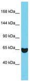 Epidermal Growth Factor Receptor Pathway Substrate 8 antibody, TA335076, Origene, Western Blot image 