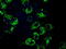 Mitochondrial Translational Release Factor 1 Like antibody, M12629, Boster Biological Technology, Immunofluorescence image 