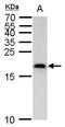 MAF BZIP Transcription Factor K antibody, GTX129240, GeneTex, Western Blot image 