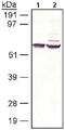 Retinoid Isomerohydrolase RPE65 antibody, ab13826, Abcam, Western Blot image 
