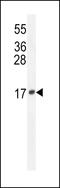 Lipocalin 10 antibody, 55-274, ProSci, Western Blot image 