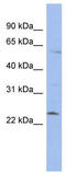 Zinc Finger Protein 239 antibody, TA343555, Origene, Western Blot image 