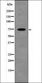 LIM domain kinase 1 antibody, orb335947, Biorbyt, Western Blot image 