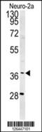 Small Nuclear Ribonucleoprotein U5 Subunit 40 antibody, 61-867, ProSci, Western Blot image 