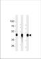 Keratin 18 antibody, TA324782, Origene, Western Blot image 