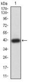 Protein Kinase AMP-Activated Non-Catalytic Subunit Gamma 3 antibody, NBP2-61797, Novus Biologicals, Western Blot image 
