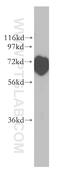 CD2 Associated Protein antibody, 51046-1-AP, Proteintech Group, Western Blot image 