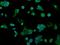 Alcohol dehydrogenase [NADP+] antibody, MA5-25010, Invitrogen Antibodies, Immunocytochemistry image 