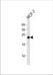 O-6-Methylguanine-DNA Methyltransferase antibody, TA325178, Origene, Western Blot image 