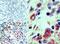 BMI1 Proto-Oncogene, Polycomb Ring Finger antibody, PA5-23308, Invitrogen Antibodies, Immunohistochemistry frozen image 